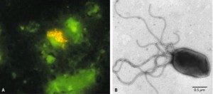 Bartonella Rochilame.